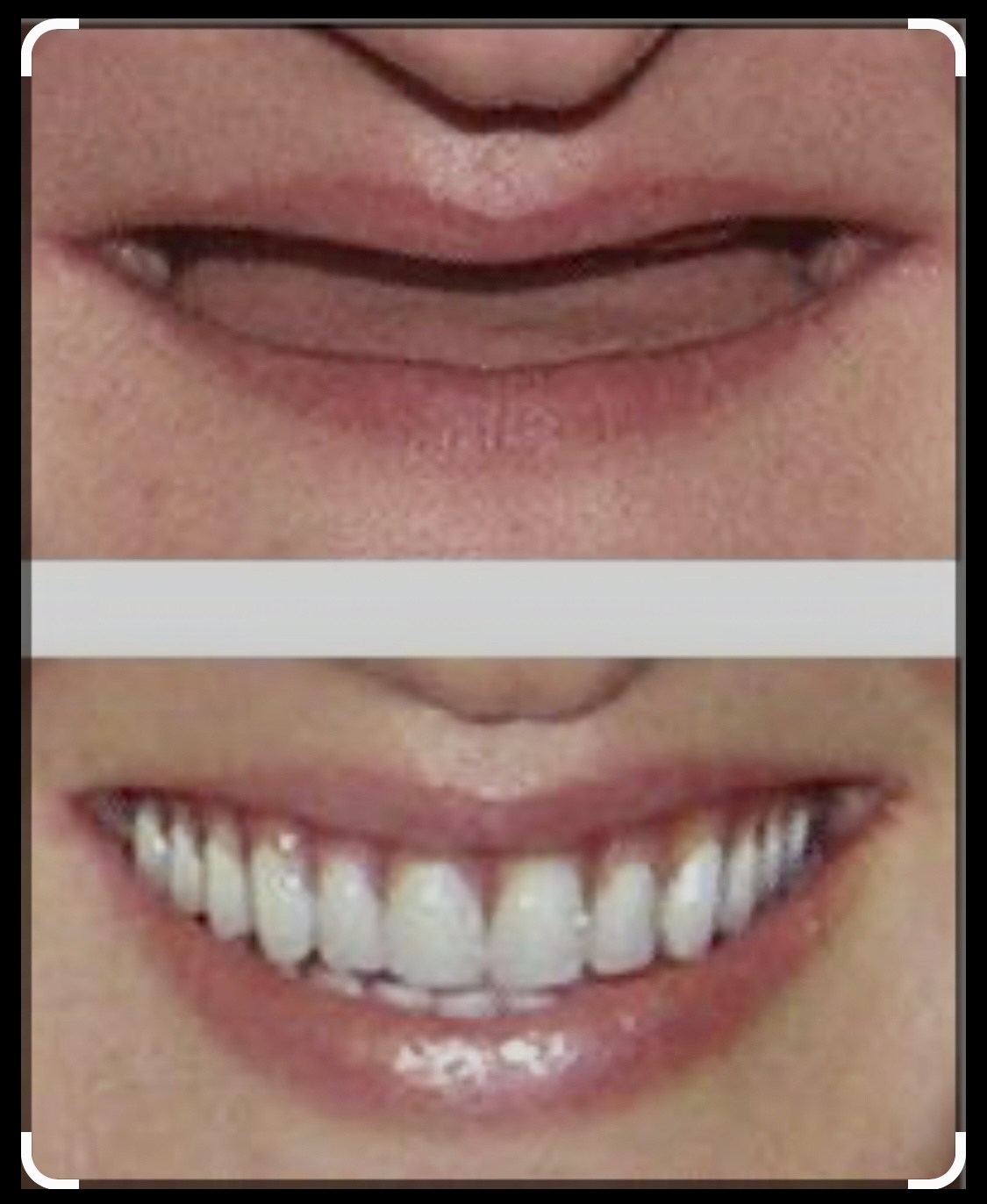 Cosmetic Dental Office Pasadena