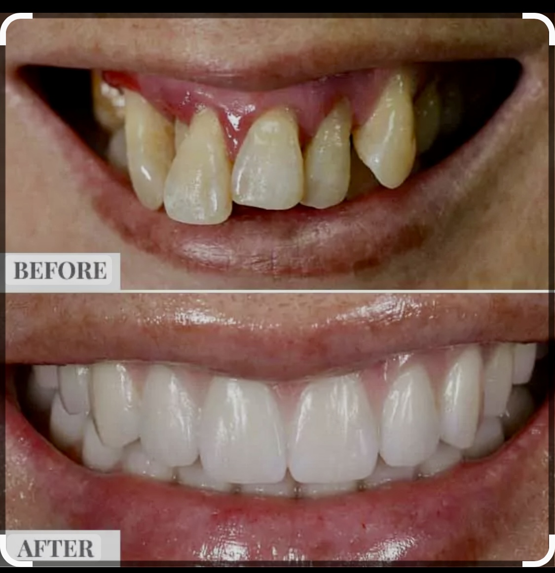 Belle Smile | TMJ Disorders, Digital Radiography and Invisalign reg