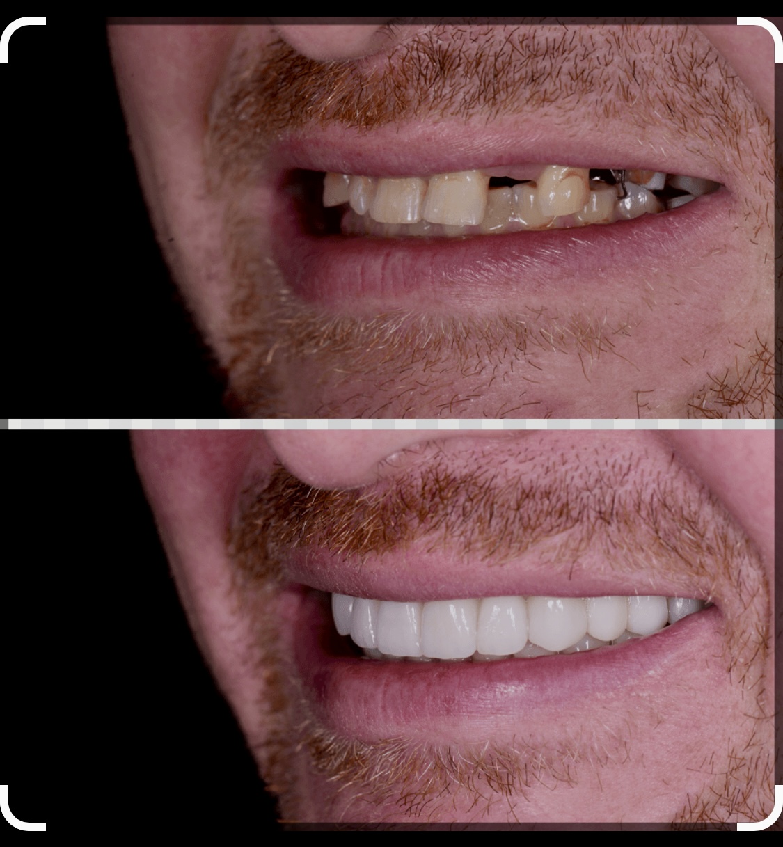 Belle Smile | Oral Exams, Root Canals and Dental Sealants